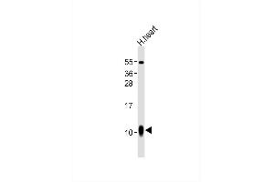 Anti--A1 Antibody at 1:1000 dilution + human heart lysates Lysates/proteins at 20 μg per lane.