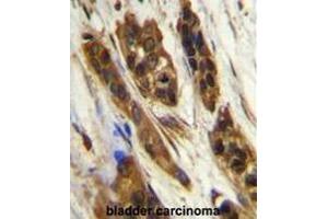 Immunohistochemistry (Paraffin-embedded Sections) (IHC (p)) image for anti-Small Nuclear Ribonucleoprotein 27kDa (U4/U6.U5) (SNRNP27) (AA 76-106), (Middle Region) antibody (ABIN954875)