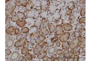 Image no. 1 for anti-F-Box and Leucine-Rich Repeat Protein 18 (FBXL18) (AA 1-111) antibody (ABIN466244) (FBXL18 抗体  (AA 1-111))