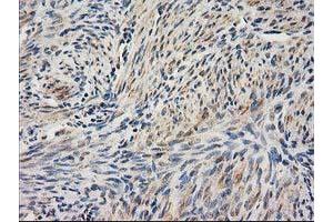 Immunohistochemical staining of paraffin-embedded Human endometrium tissue using anti-UBA2 mouse monoclonal antibody. (UBA2 抗体)
