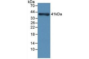 Detection of Recombinant NPHN, Rat using Monoclonal Antibody to Nephrin (NPHN) (Nephrin 抗体  (AA 39-106))