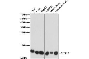 Western blot analysis of extracts of various cell lines using SEC61B Polyclonal Antibody at dilution of 1:1000. (SEC61B 抗体)