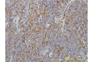 Immunostaining (ISt) image for anti-Coronin, Actin Binding Protein, 1B (CORO1B) (AA 1-489) antibody (ABIN566100)
