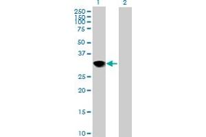 Western Blot analysis of CENPH expression in transfected 293T cell line by CENPH MaxPab polyclonal antibody. (CENPH 抗体  (AA 1-247))