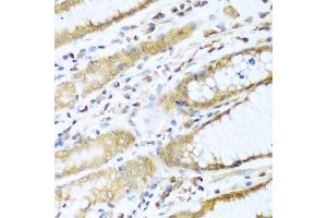 Immunohistochemistry of paraffin-embedded human stomach using UBE2L3 antibody.