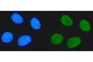IF analysis of TRIM24 using anti-TRIM24 antibody (ABIN7602358).