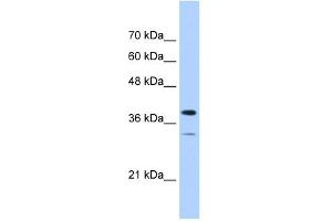 PGAM2 antibody used at 1 ug/ml to detect target protein. (PGAM2 抗体)