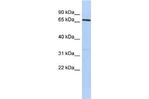 WB Suggested Anti-PRDM1 Antibody Titration:  0. (PRDM1 抗体  (Middle Region))