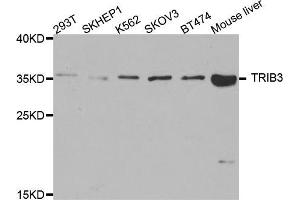 Western blot analysis of extracts of various cell lines, using TRIB3 antibody (ABIN5975258) at 1/1000 dilution. (TRIB3 抗体)