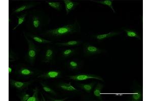 Immunofluorescence of purified MaxPab antibody to FANCF on HeLa cell. (FANCF 抗体  (AA 1-374))
