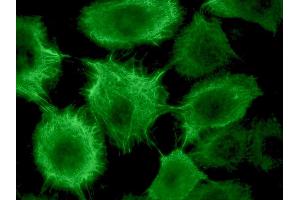 Image no. 3 for anti-Keratin 17 (KRT17) antibody (ABIN335340) (KRT17 抗体)