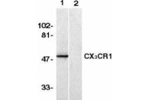 Image no. 1 for anti-Chemokine (C-X3-C Motif) Receptor 1 (CX3CR1) (AA 2-21) antibody (ABIN201961) (CX3CR1 抗体  (AA 2-21))