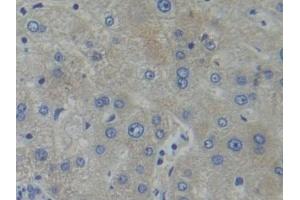 Detection of PFKP in Human Liver Tissue using Polyclonal Antibody to Phosphofructokinase, Platelet (PFKP) (PFKP 抗体  (AA 553-753))