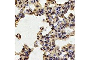 Immunohistochemical analysis of TPP2 staining in mouse lung formalin fixed paraffin embedded tissue section. (Tpp2 抗体)