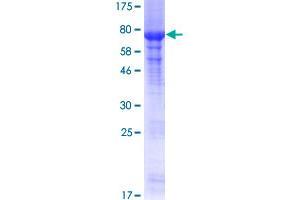 Image no. 1 for Protein Arginine Methyltransferase 2 (PRMT2) (AA 1-433) protein (GST tag) (ABIN1316329) (PRMT2 Protein (AA 1-433) (GST tag))