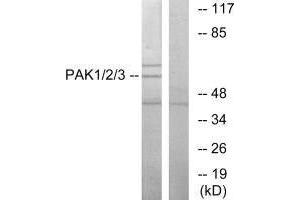 Western blot analysis of extracts from NIH-3T3 cells, using PAK1/2/3 (Ab-423/402/421) antibody. (PAK1/2/3 抗体  (Thr402, Thr421, Thr423))