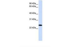 anti-Zinc Finger, DHHC-Type Containing 19 (ZDHHC19) (AA 201-250) antibody