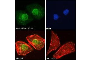 ABIN571072 Immunofluorescence analysis of paraformaldehyde fixed HeLa cells, permeabilized with 0.