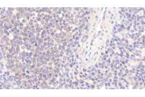 Immunohistochemistry (IHC) image for anti-Wiskott-Aldrich Syndrome (Eczema-thrombocytopenia) (WAS) (AA 39-251) antibody (ABIN7444415)