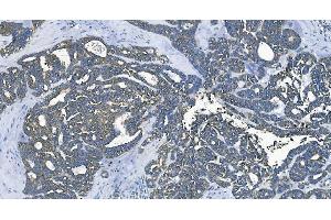 IHC analysis of EEF2/Elongation factor 2 using anti-EEF2/Elongation factor 2 antibody (ABIN7603142).