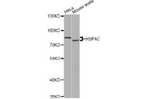 Western blot analysis of extracts of various cell lines, using HSPA5 antibody (ABIN4903982) at 1:500 dilution. (GRP78 抗体)