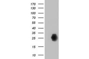 Western Blotting (WB) image for anti-Zinc Finger, AN1-Type Domain 2B (ZFAND2B) antibody (ABIN1501801) (ZFAND2B 抗体)