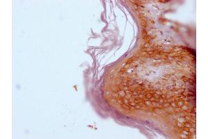 IHC image of ABIN7180745 diluted at 1:100 and staining in paraffin-embedded human skin tissue performed on a Leica BondTM system.