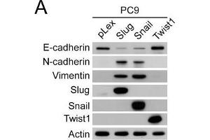 Snail- and Slug-induced EMT promoted drug resistance of parental PC9 and HCC827 cells. (TWIST1 抗体  (Center))
