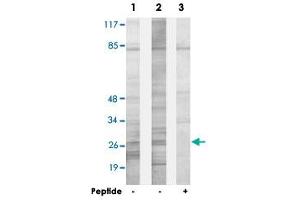 Western blot analysis of extracts from HepG2 cells (Lane 1) and HeLa cells (Lane 2 and lane 3), using SPIC polyclonal antibody . (SPIC 抗体)