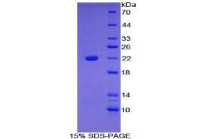 SDS-PAGE analysis of Mouse Bleomycin Hydrolase Protein. (BLMH 蛋白)
