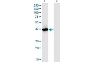 Western Blot analysis of PRMT6 expression in transfected 293T cell line by PRMT6 monoclonal antibody (M02), clone 3C3.