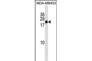 ZN Antibody (C-term) (ABIN1536745 and ABIN2850068) western blot analysis in MDA-M cell line lysates (35 μg/lane). (ZNF747 抗体  (C-Term))