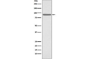 Western blot analysis of Phospho-STAT1 (S727) expression in HeLa cell lysate treated with etoposide.