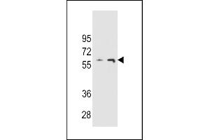 THUM3 Antibody (Center) (ABIN654774 and ABIN2844455) western blot analysis in  and  cell line lysates (35 μg/lane). (THUMPD3 抗体  (AA 194-223))