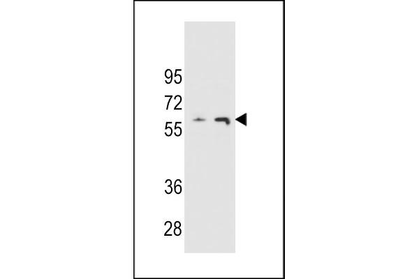 THUMPD3 抗体  (AA 194-223)