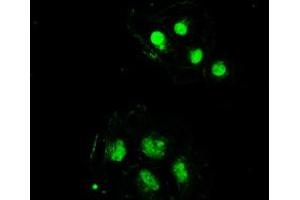 Image no. 16 for anti-Sjogren Syndrome Antigen B (SSB) antibody (ABIN1501146) (SSB 抗体)