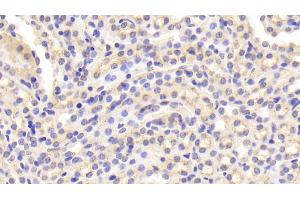 Detection of CTSD in Mouse Kidney Tissue using Polyclonal Antibody to Cathepsin D (CTSD)