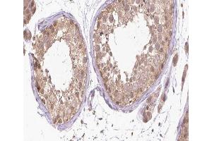 ABIN6266463 at 1/200 staining human Testis tissue sections by IHC-P. (Retinoic Acid Receptor alpha 抗体  (pSer77))