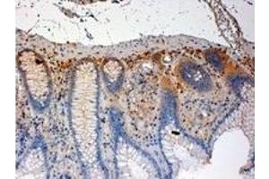 Image no. 3 for anti-C-Src tyrosine Kinase (CSK) (C-Term) antibody (ABIN374096) (CSK 抗体  (C-Term))