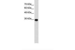 Image no. 1 for anti-Pirin (PIR) (C-Term) antibody (ABIN203307) (Pirin 抗体  (C-Term))