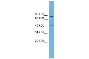 WB Suggested Anti-DNM1L Antibody Titration: 0. (Dynamin 1-Like 抗体  (N-Term))