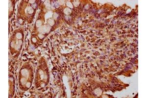 IHC image of ABIN7165594 diluted at 1:300 and staining in paraffin-embedded human small intestine tissue performed on a Leica BondTM system. (FEV 抗体  (AA 1-97))