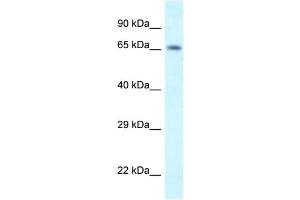 WB Suggested Anti-Shkbp1 Antibody   Titration: 1. (SHKBP1 抗体  (N-Term))