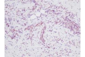 Image no. 3 for anti-Melanoma Inhibitory Activity (MIA) antibody (ABIN464851) (MIA 抗体)