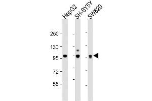 Western Blot at 1:2000 dilution Lane 1: HepG2 whole cell lysate Lane 2: SH-SY5Y whole cell lysate Lane 3: SW620 whole cell lysate Lysates/proteins at 20 ug per lane. (PROX1 抗体  (AA 492-520))