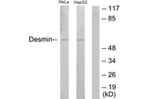Western blot analysis of extracts from HeLa/HepG2 cells, using Desmin (Ab-60) Antibody.