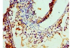 Immunohistochemistry of paraffin-embedded human testis tissue using ABIN7148465 at dilution of 1:100 (COG7 抗体  (AA 511-770))