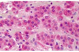 Human Adrenal: Formalin-Fixed, Paraffin-Embedded (FFPE) (SMAD3 抗体  (AA 100-150))
