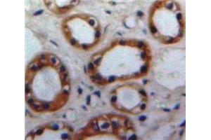 Used in DAB staining on fromalin fixed paraffin-embedded Kidney tissue (Nischarin 抗体  (AA 1335-1435))