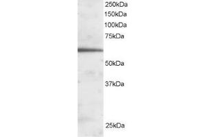Western Blotting (WB) image for anti-Forkhead Box A2 (FOXA2) (C-Term) antibody (ABIN185022)
